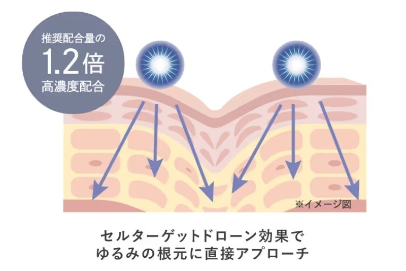 ゆるみ対策